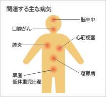 関連する主な病気