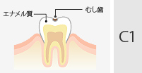C1
