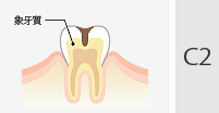 C2